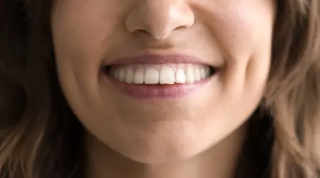 Are Implants Better Than Dentures?