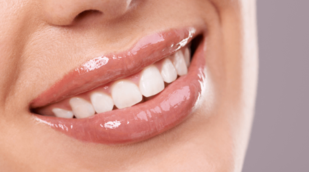 Truths & Myths About Teeth Whitening: Separating Fact from Fiction